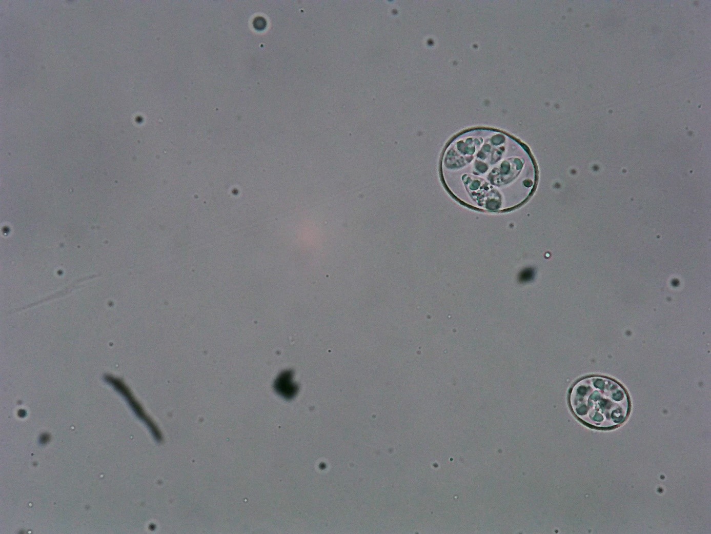 Sporulated oocyst of Eimeria maxima and E. Acervulina 